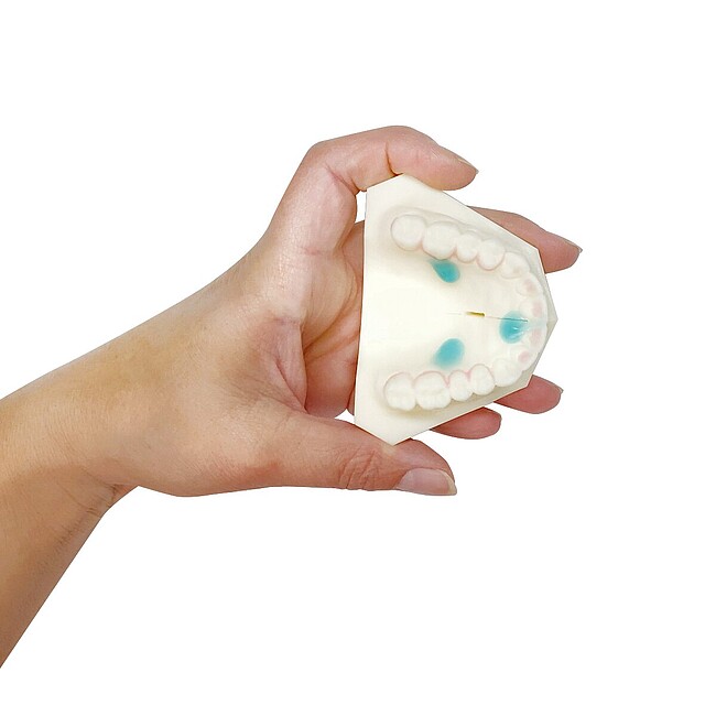 Hand holding a dental mold with white teeth and blue markings, seen against a white background, indoors or in a clinic setting