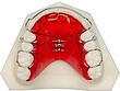 Close-up of a red sports mouthguard in a mouth, held open by hands for fitting.