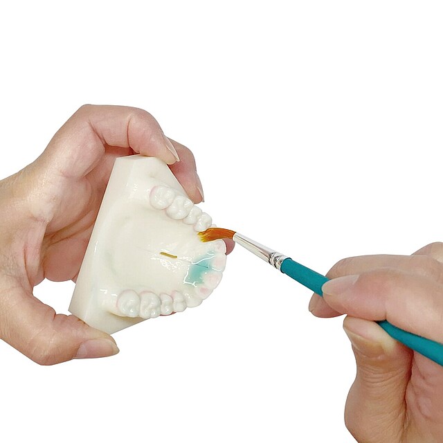 Hands hold a dental model of upper teeth as a brush coats a tooth with blue-green dental material, demonstrating a sealant or bonding technique.